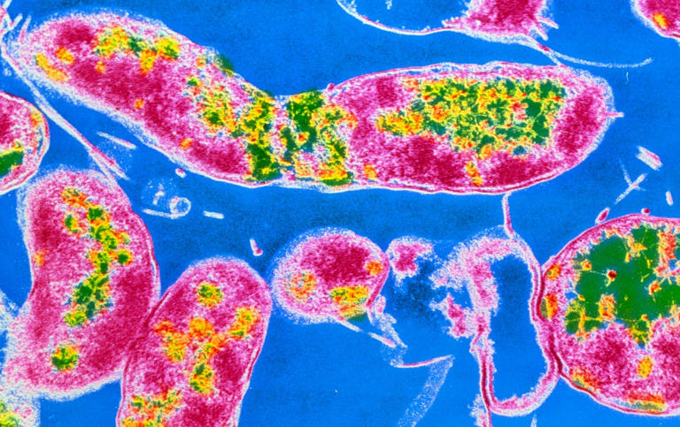 Almost half of infection-linked cancers were caused by H. pylori, a bacterium that infects the stomach 